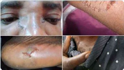 A bolt driver has narrated his experience in the hands of SARS operatives