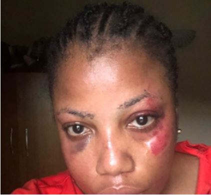 Domestic violence